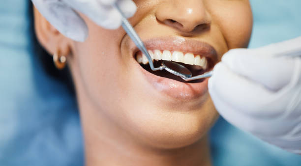 Best Emergency Dental Care for Broken or Chipped Teeth in Mahnomen, MN
